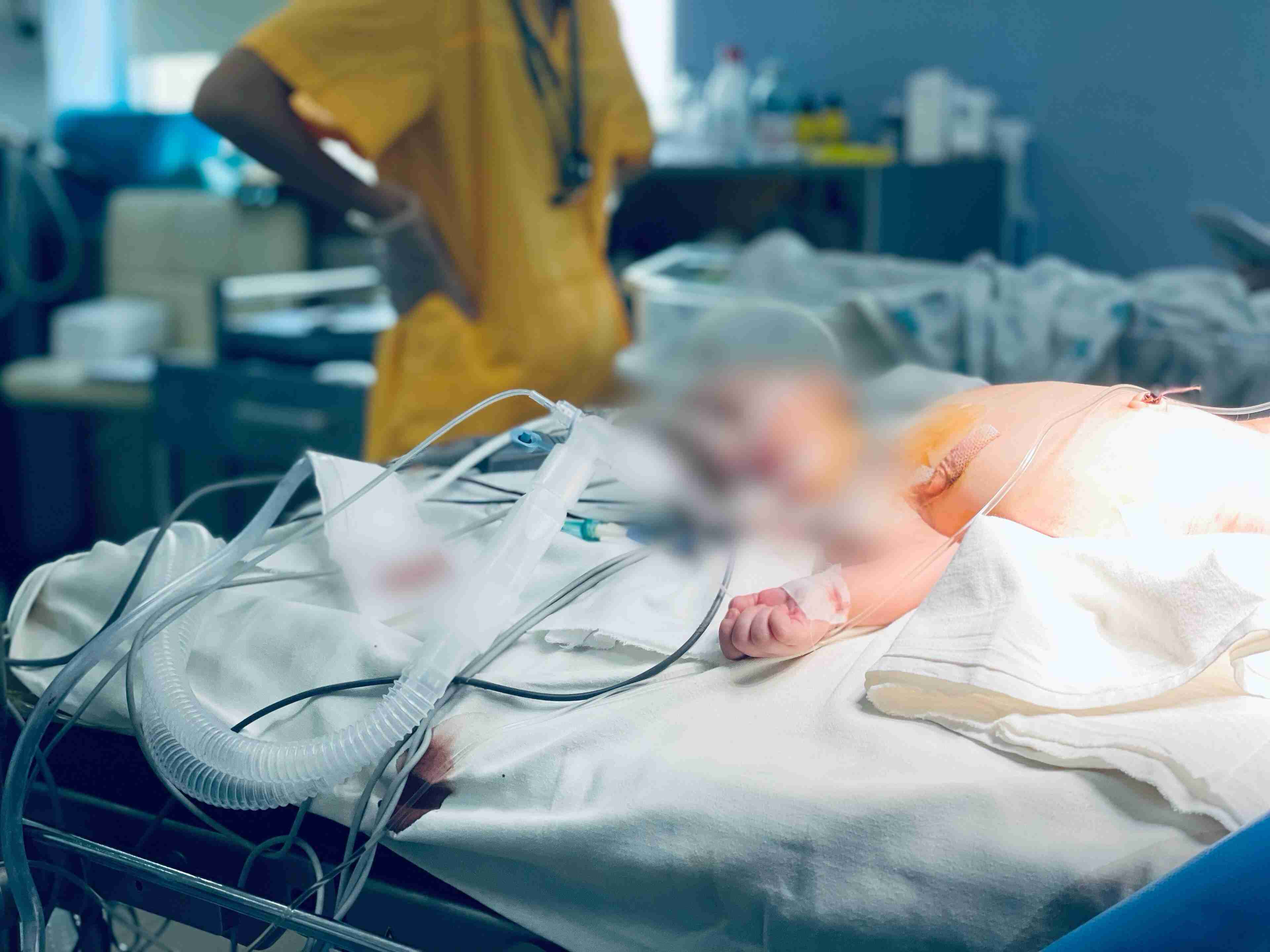 Львівські медики врятували трьох немовлят із величезними півкілограмовими пухлинами (ФОТО)