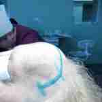 Львівські нейрохірурги видалили величезну пухлину на голові жінки (фото)