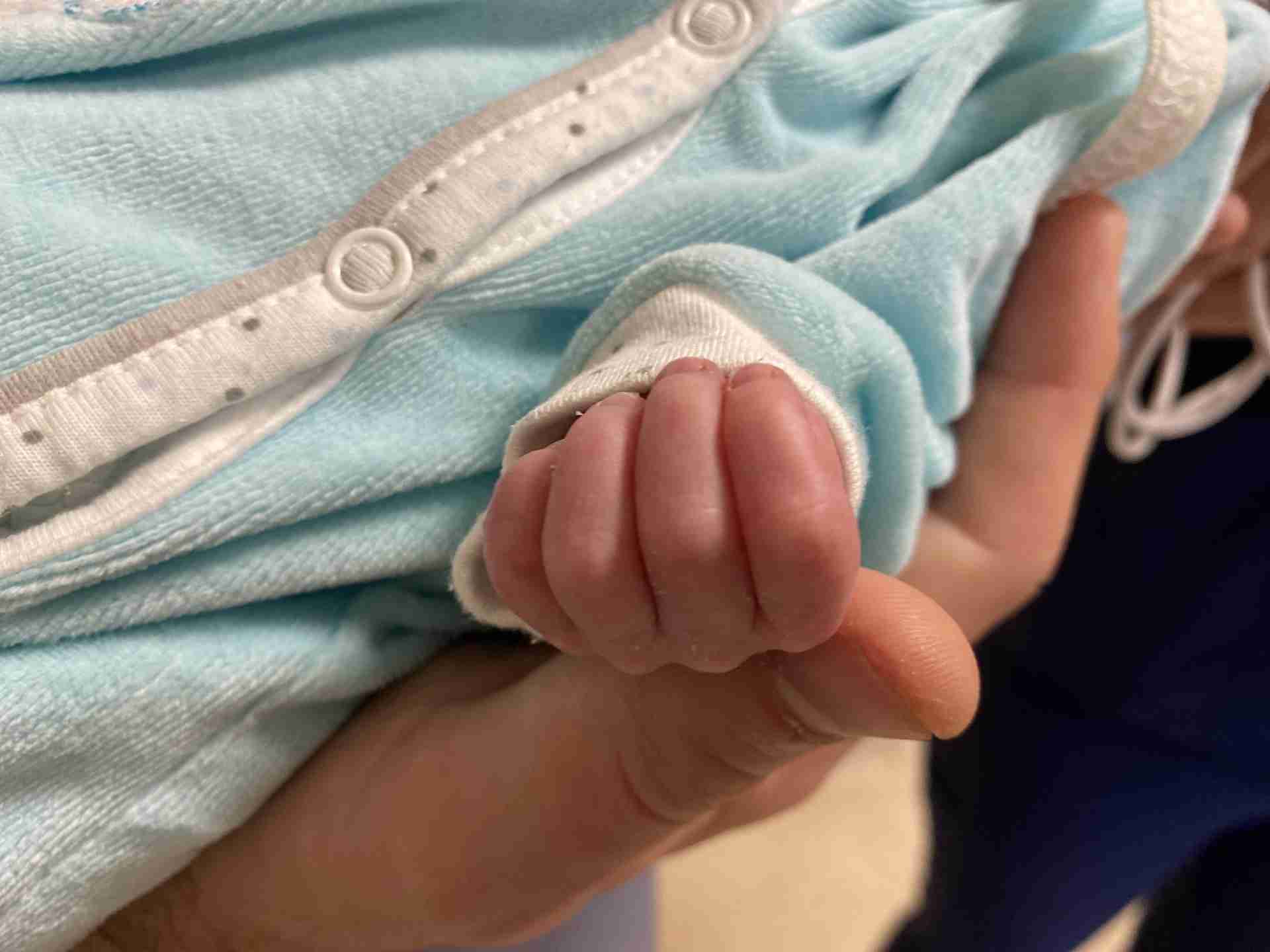 Малюк не міг самостійно дихати: львівські медики врятували немовля з критичною вадою серця (ФОТО)