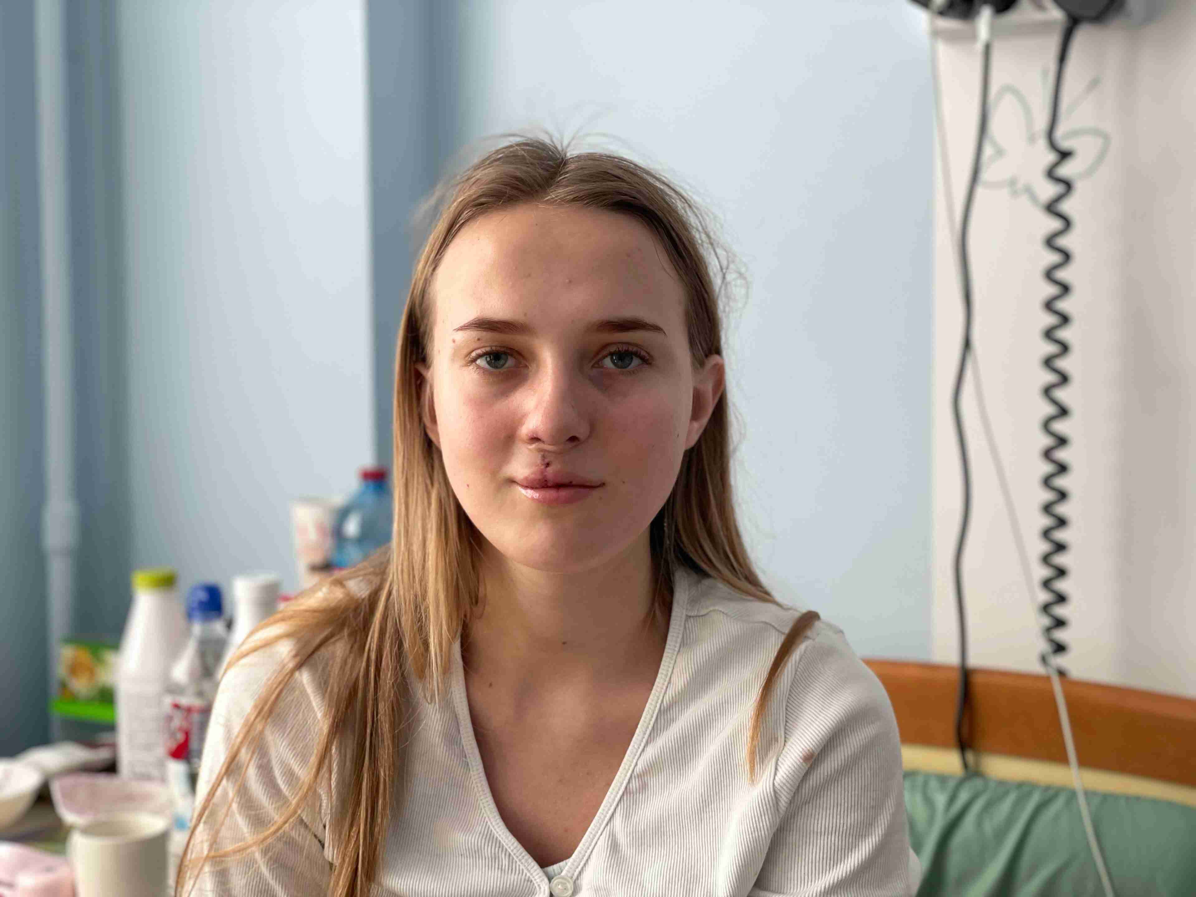 Мріяла все життя: у Львові провели операцію на обличчі молодій дівчині (ФОТО)