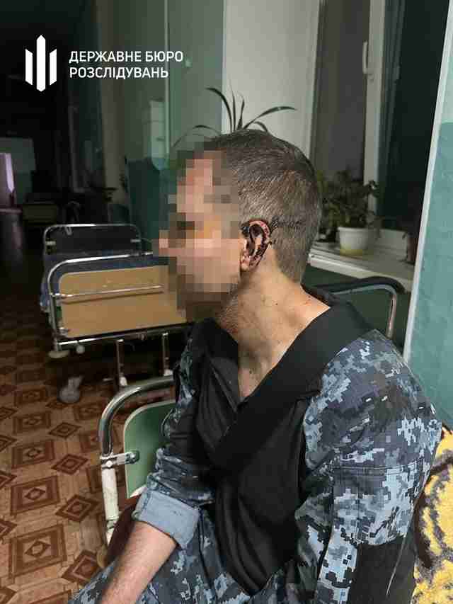 На Одещині у військовій частині побили військовослужбовця (ФОТО)