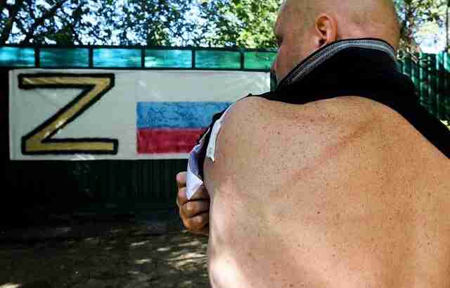 На росії невідомі напали на фаната «z» і набили букву на спині (ФОТО 18+)