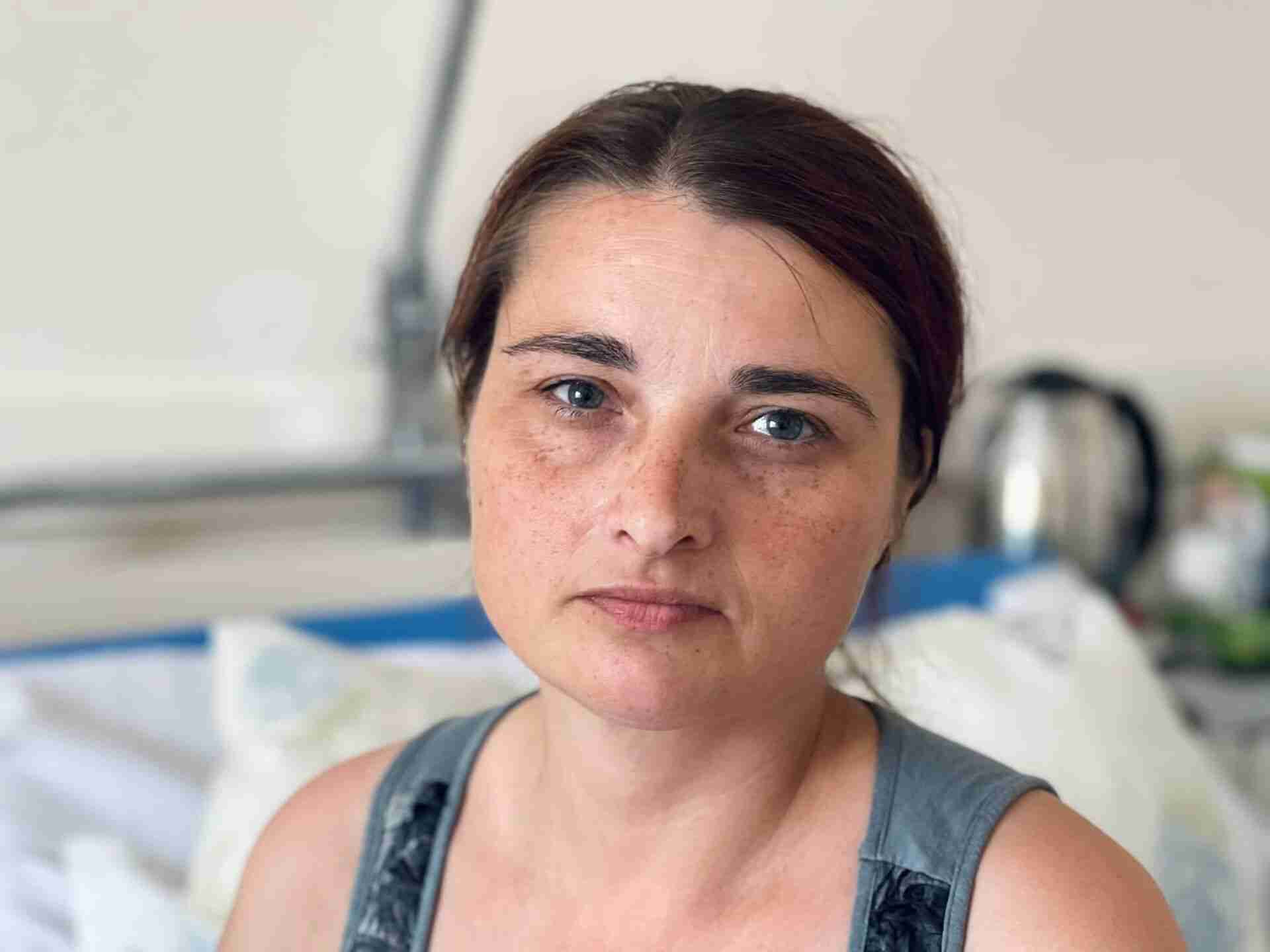 Пережила справжнє пекло: у Львові прооперували жінку, яка втратила сім'ю під обстрілом