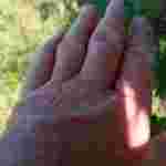 Під час збору мелітопольської черешні працівниця саду отримала хімічні опіки рук (ФОТО)
