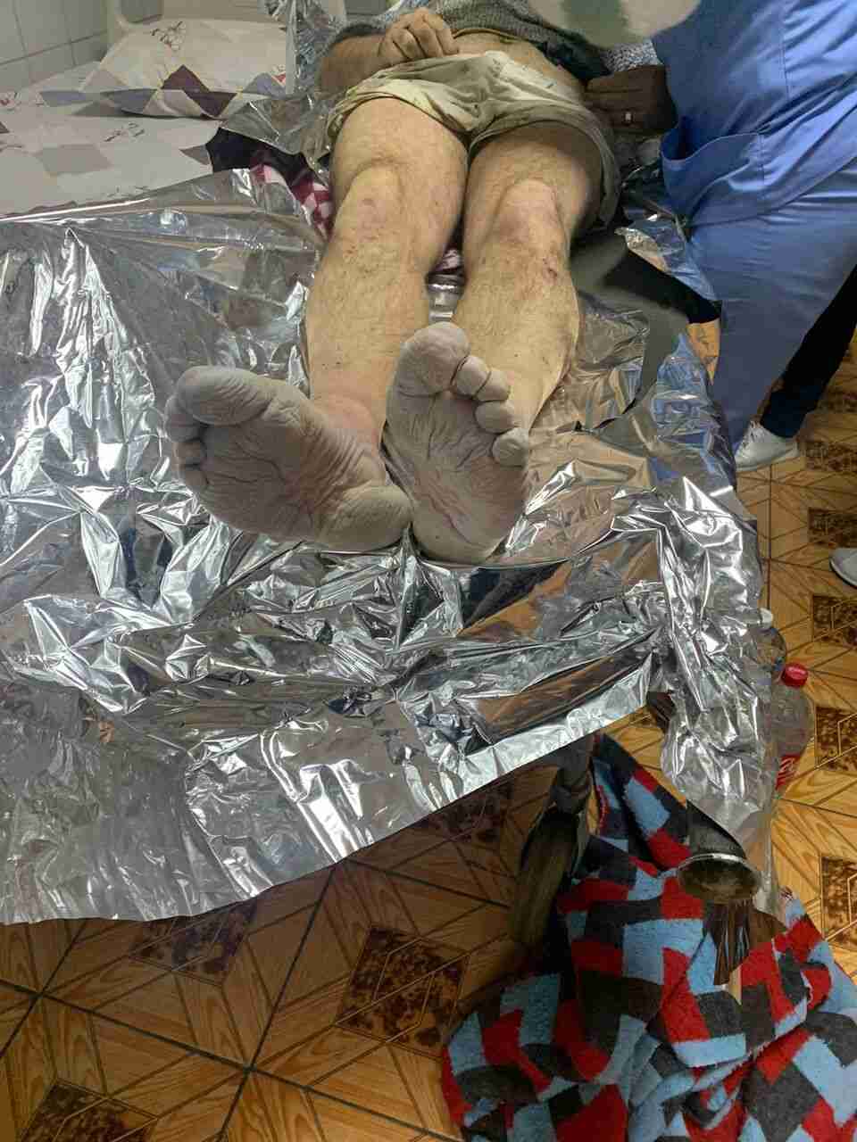 У горах Закарпаття знайшли виснаженого чоловіка з обмороженими ногами (ФОТО)