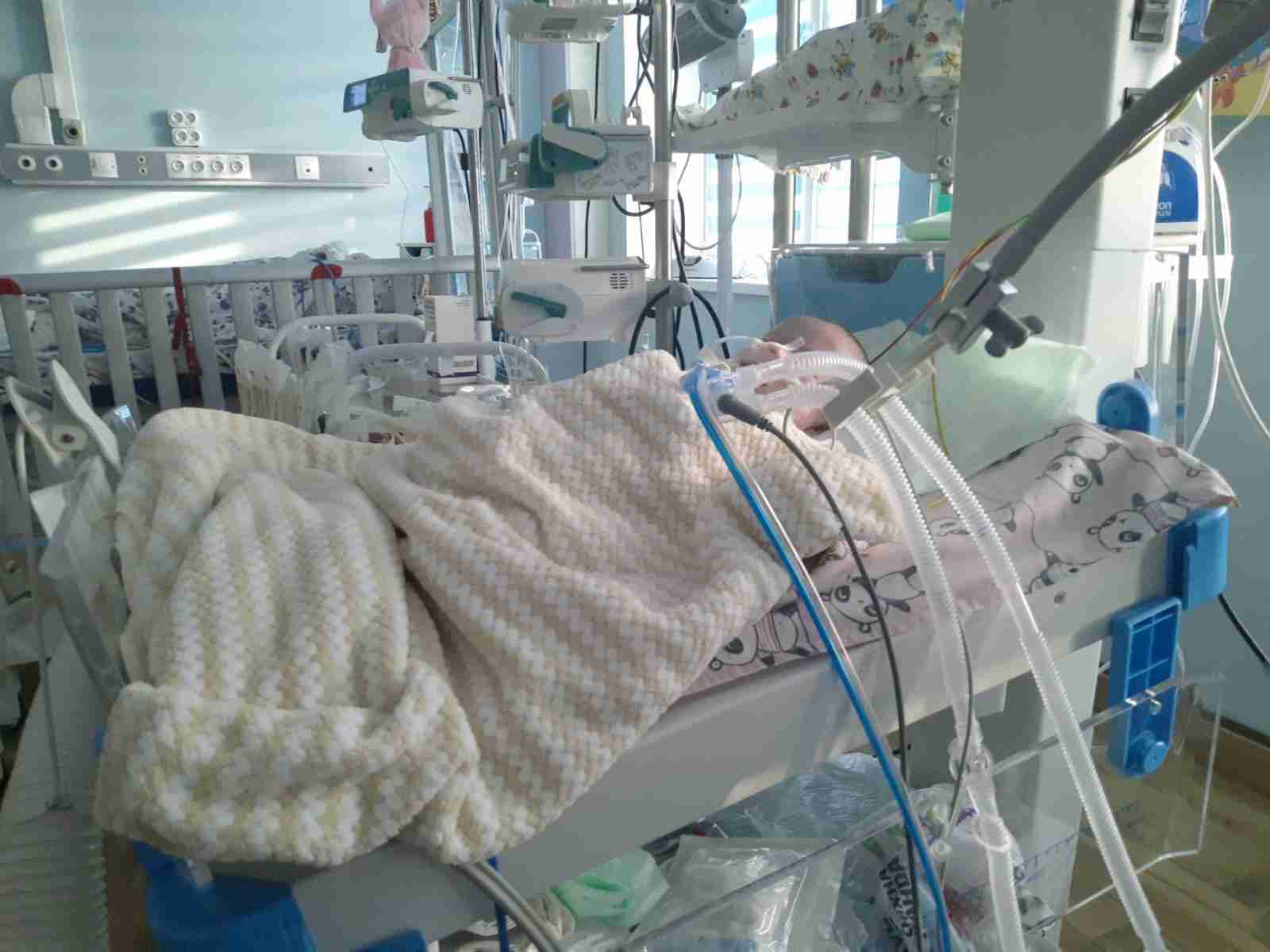У Львові медики врятували немовля, яке не могло дихати через важку хворобу (ФОТО)