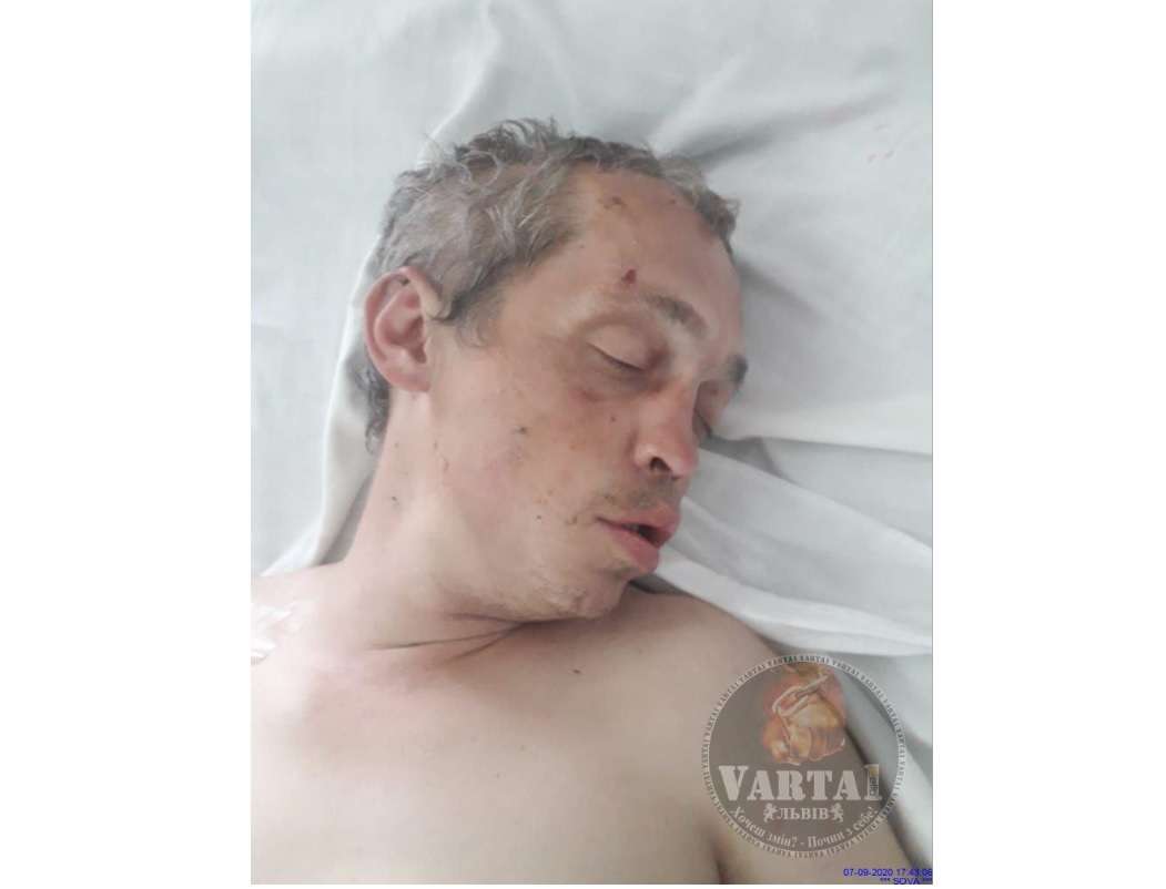 У Львові просять допомогти впізнати чоловіка, який лежить у лікарні (фото)