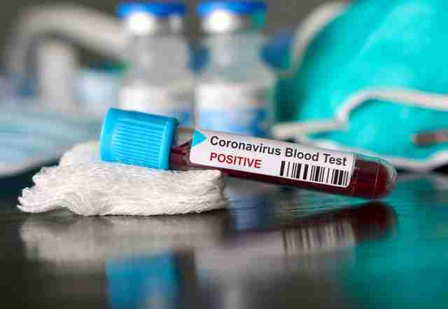 У Львові за добу померло п’ятеро хворих на коронавірус