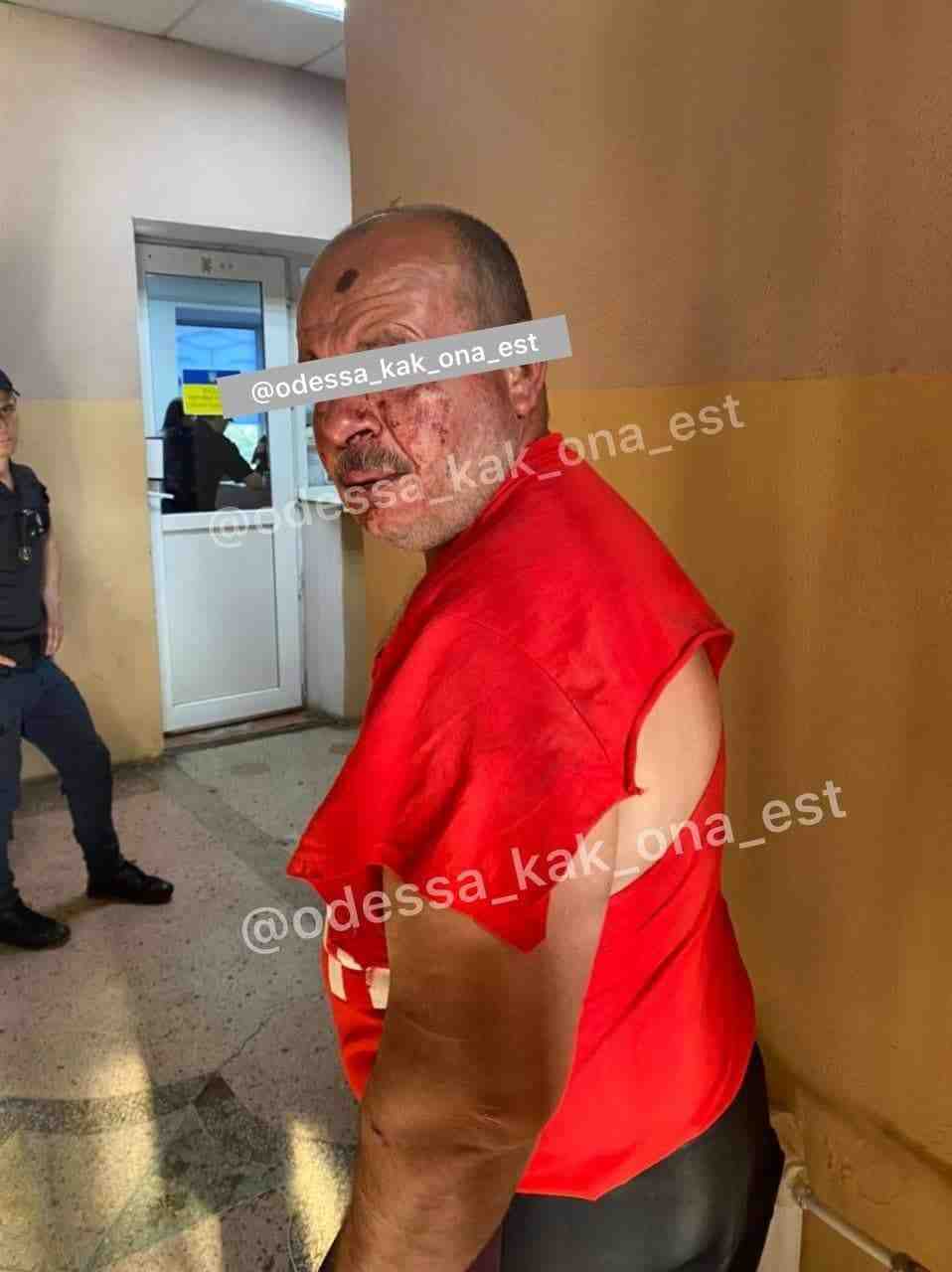 В Одесі вчинили самосуд над чоловіком, який намагався затягнути у сквер дитину з ДЦП (фото)