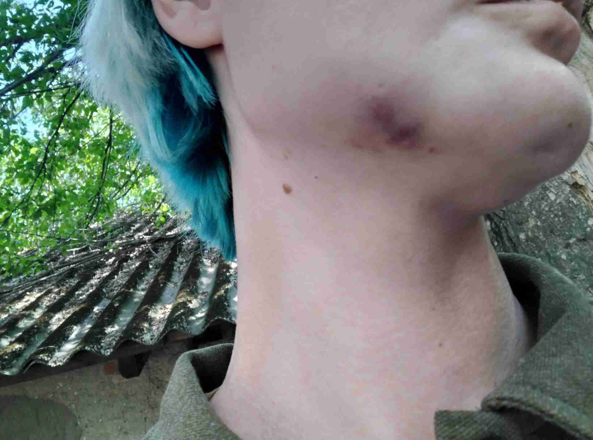 Вдарив кулаком в голову і щелепу: жінка заявила про побиття представником Закарпатського ОТЦК (ФОТО)