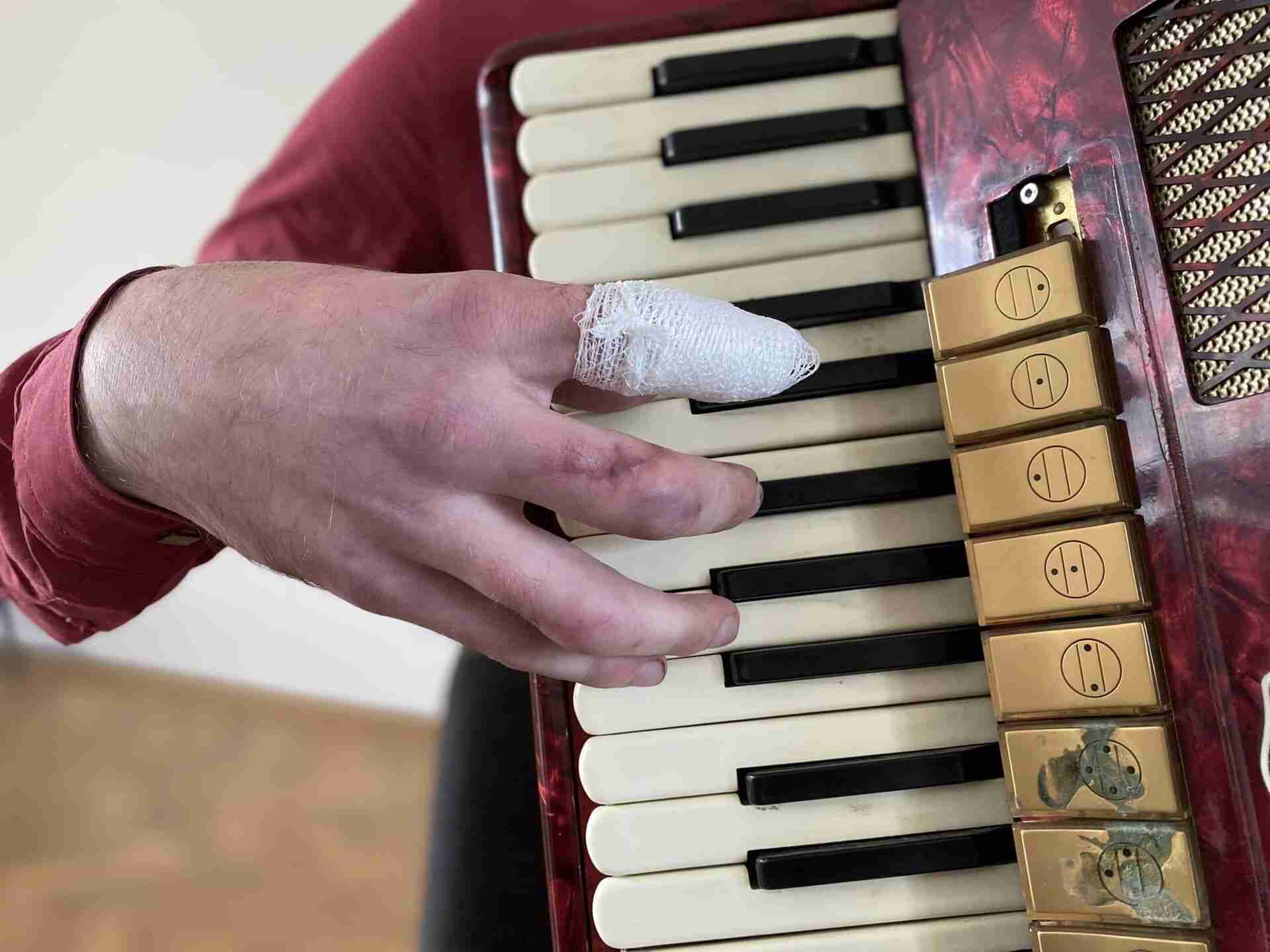 Врятований маестро: львівські хірурги врятували пальці руки молодого вчителя музики (ФОТО)